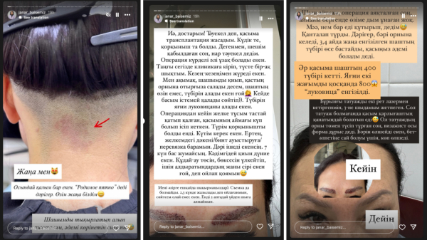 «Желкем тас болып, қасым ісіп кетті»: Тележурналист Жанар Байсеміз трансплантация жасатты (ФОТО)